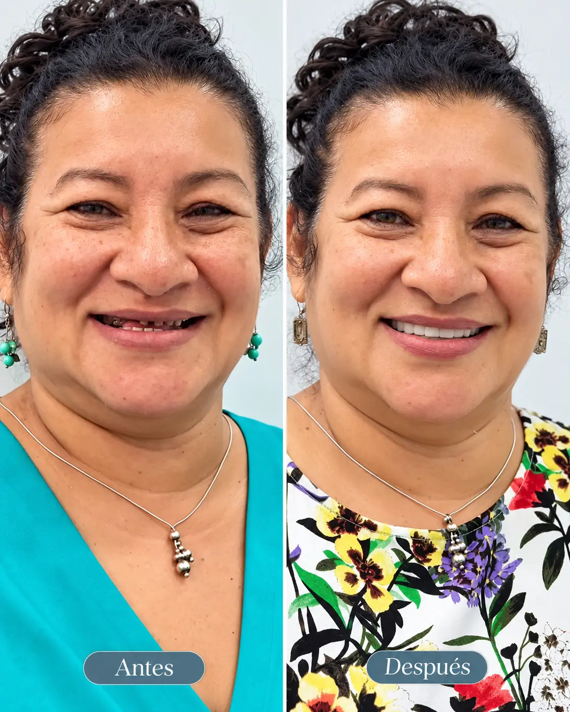 Before-and-after photographs of an international patient