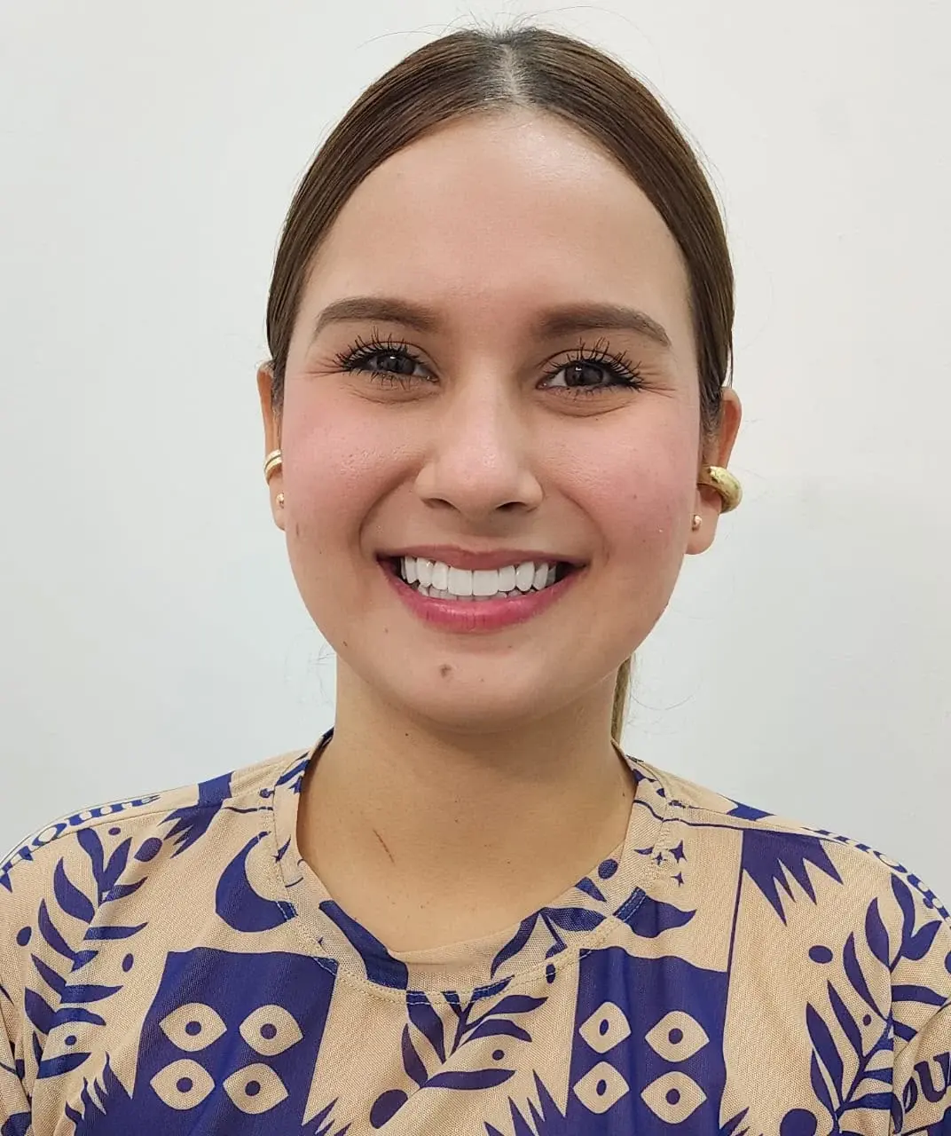 Sonrisa de una paciente de Metanoia