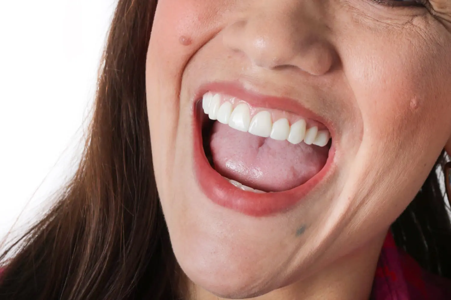 Detalle de la sonrisa de una paciente